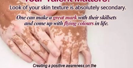 world vitiligo day