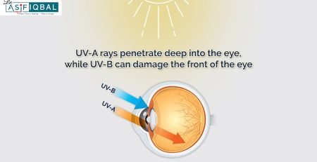 Illustration of UV rays affecting the eye