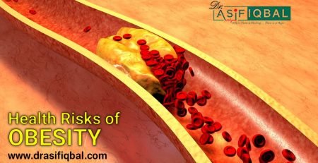 Health risks of obesity